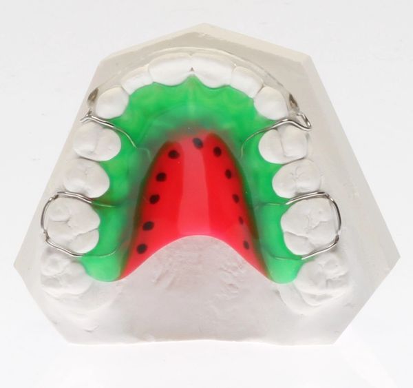 Retainers Canadian Orthodontic Laboratories